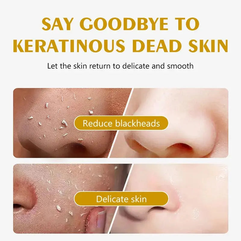 Exfoliating Gel Beauty